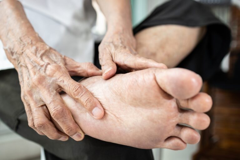 Diseases,Of,Osteoarthritis,Or,Rheumatoid,Arthritis,Can,Affect,The,Joints